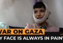 Severe injuries change 12-year-old Mazyouna’s life in Gaza