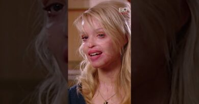 Young woman’s inspiring recovery from acid attack | 60 Minutes Australia